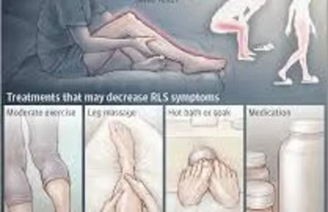Baclofen and Restless Leg Syndrome: Can It Provide Relief?