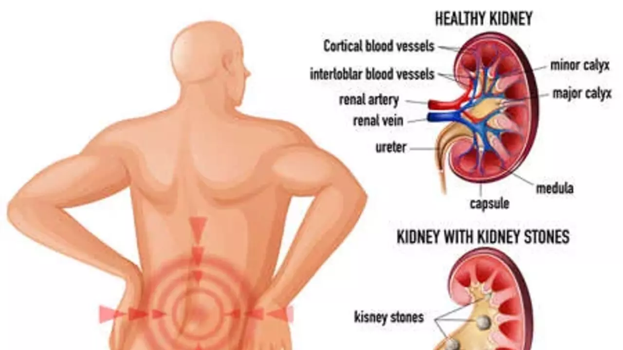 Cholestyramine and Kidney Health: What You Should Know