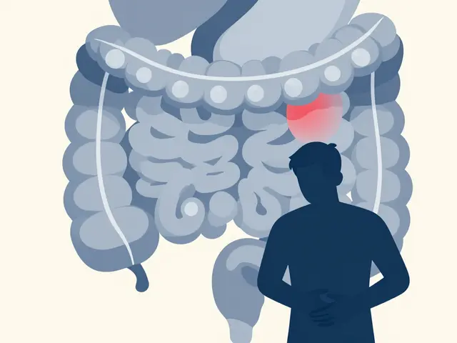 Diverticulitis: Understanding Inflamed Pouches and Effective Treatment Strategies